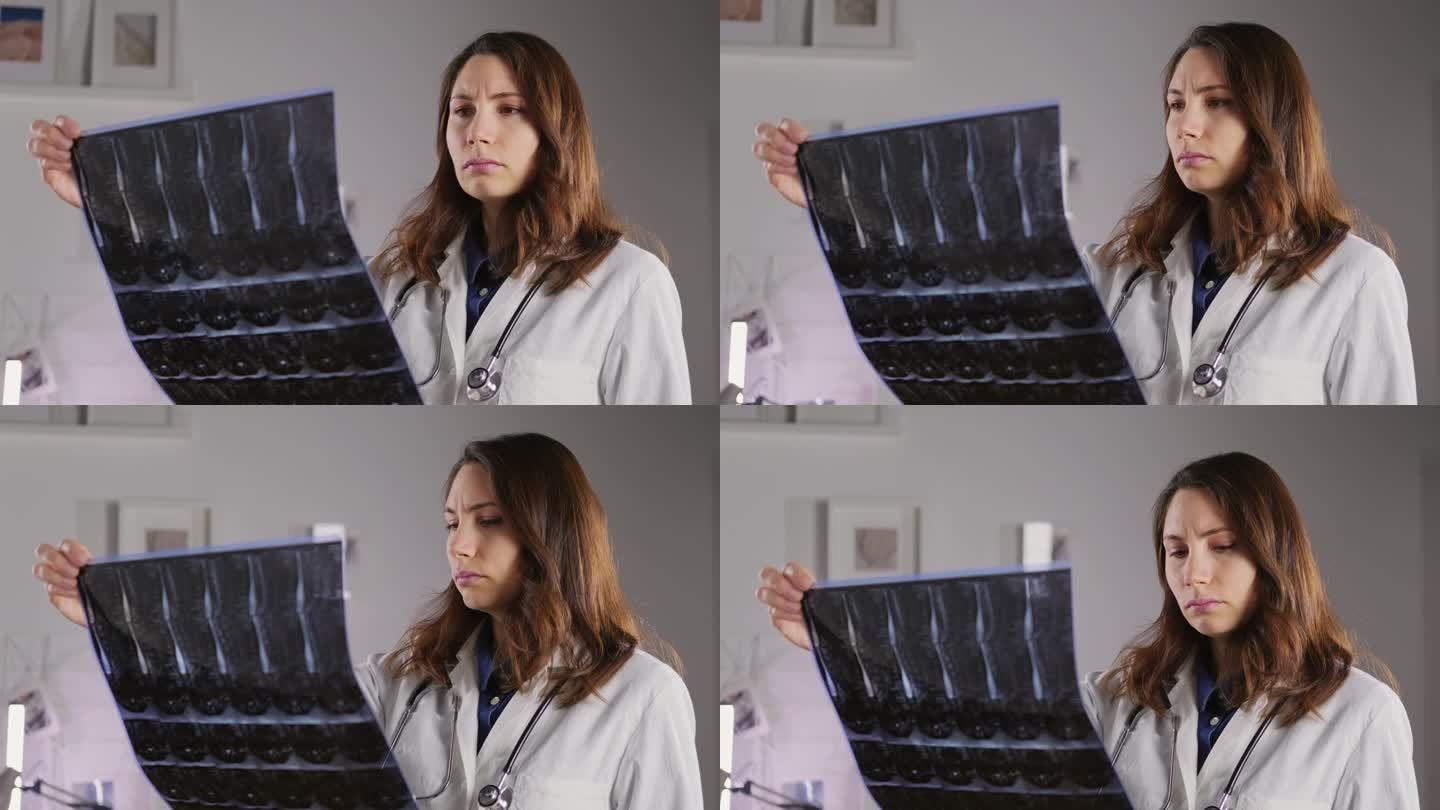 一位身穿白大褂的年轻女医生拿着脊椎骨骼的x光片进行检查。突出和骨折的医学和治疗