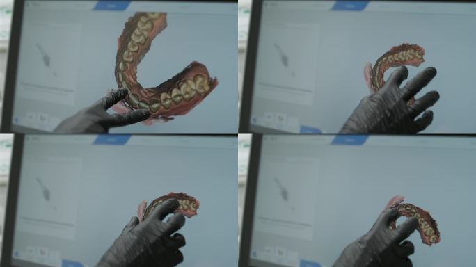 医生在诊所里扫描病人的牙齿。牙医手里拿着一个手动3D扫描仪，用来扫描下巴和嘴巴。牙齿健康。在医疗监视