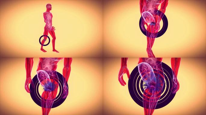 4K动画对骨关节炎和膝关节病理的影响