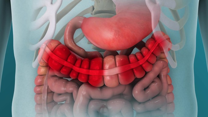 肠易激综合征疼痛痉挛3D动画