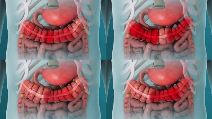 肠易激综合征疼痛痉挛3D动画