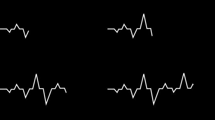 心电图线在黑色背景上动画。