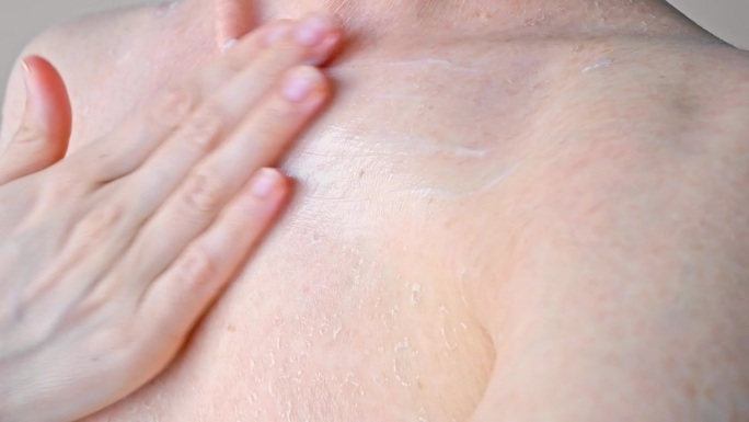 用面霜滋润胸部干燥问题肌肤近景医药保健用面霜治疗皮炎和皮肤干燥，用面霜滋润肌肤的概念