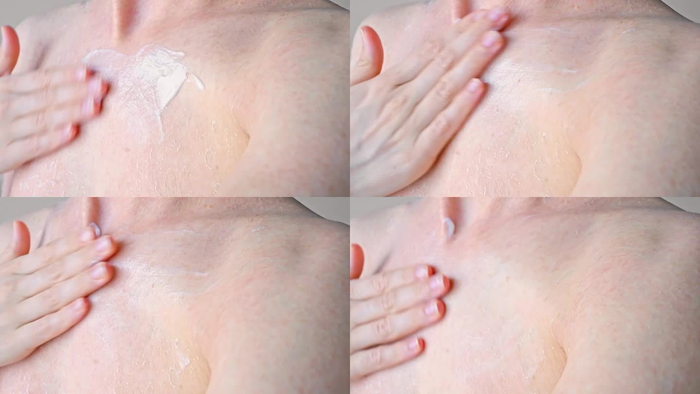 用面霜滋润胸部干燥问题肌肤近景医药保健用面霜治疗皮炎和皮肤干燥，用面霜滋润肌肤的概念