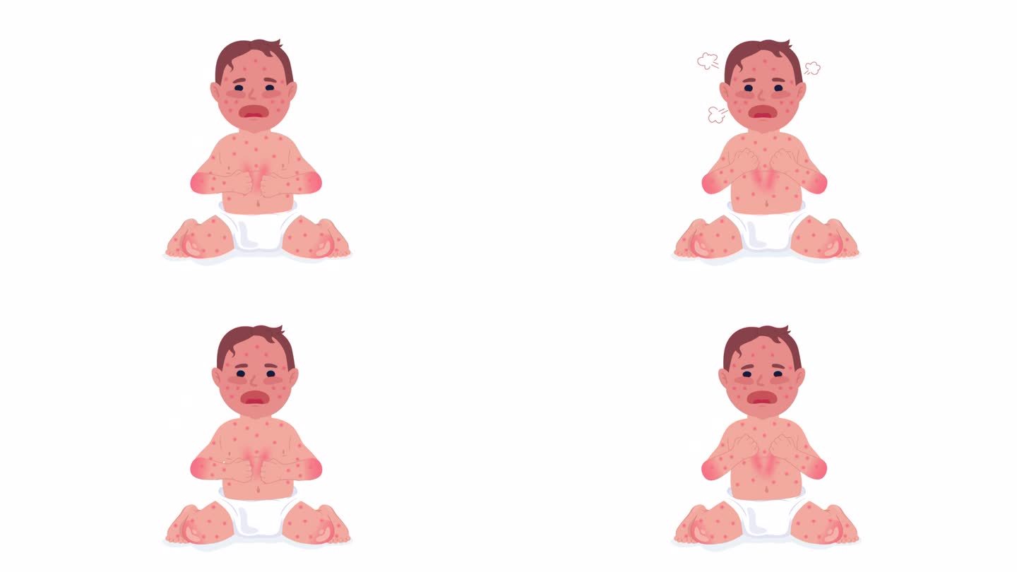 哭闹的麻疹宝宝2D人物动画。