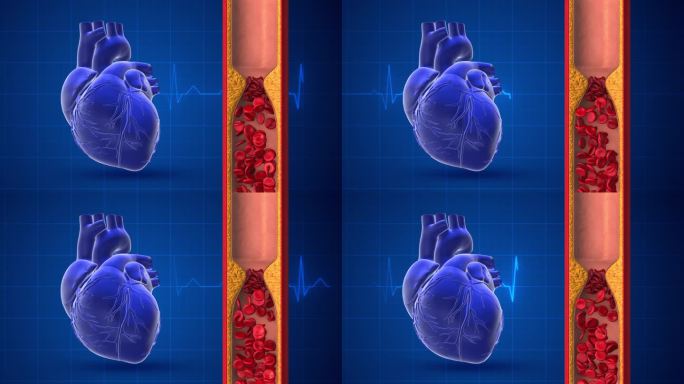 一颗动脉阻塞的心脏还有脉搏痕迹