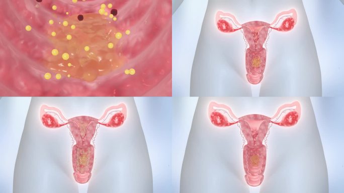 女性妇科 铲除细菌 凝胶 宫颈 子宫卵巢