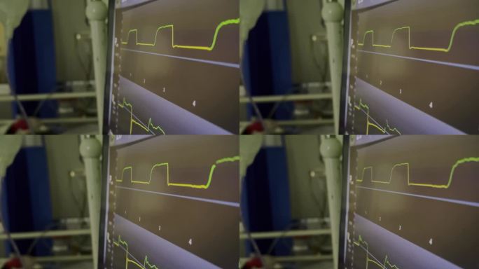 机械通风在儿科重症监护病房4K库存视频的图形