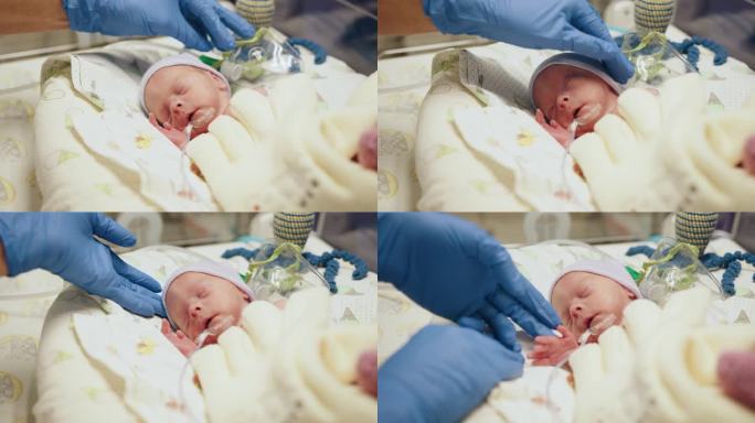 儿童健康，新生儿在医疗新生儿重症监护病房手术后躺在连接人工呼吸器的压力室中。
