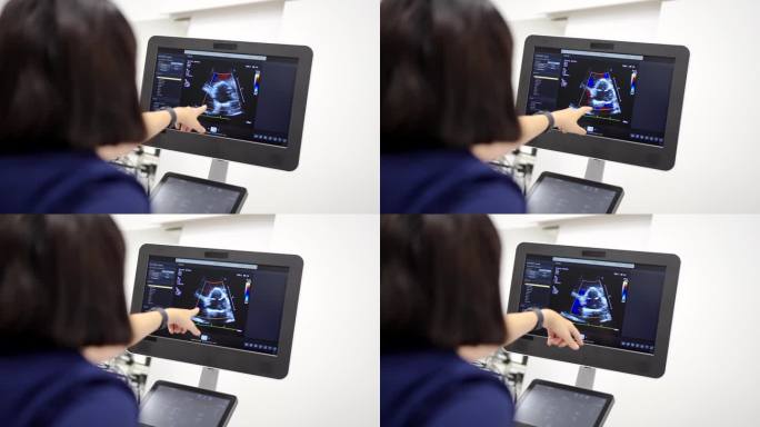 心脏病专家在做超声心动图时指着屏幕