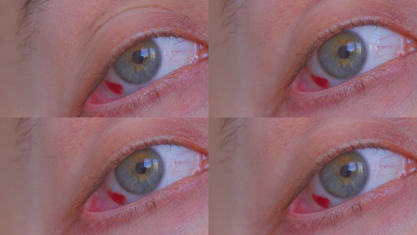 充血的眼睛。伙计，一个红红的，流血的眼球。眼睛受伤流血。有选择性的重点