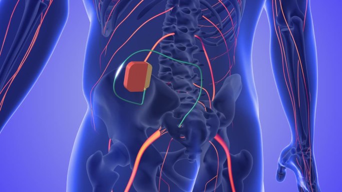 骶神经刺激医学概念