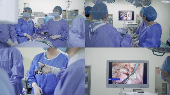腹腔镜微创手术