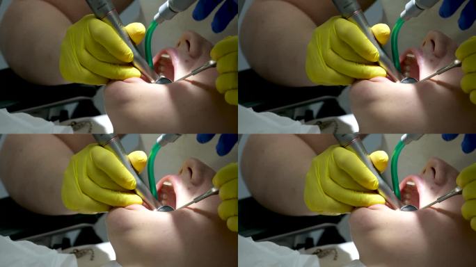 戴着乳胶手套的牙医在诊所开灯检查病人的牙齿