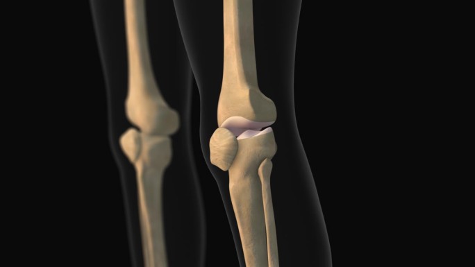 膝关节疼痛的医学动画