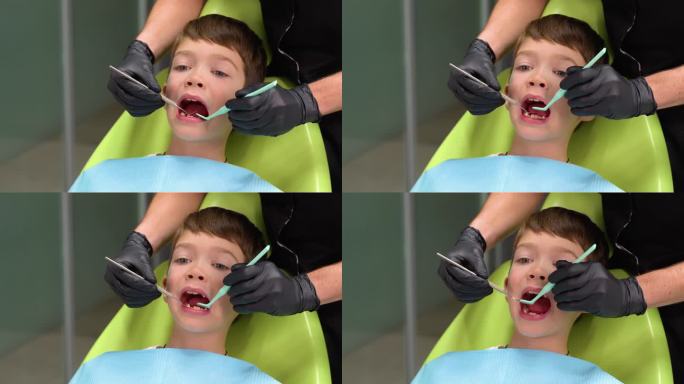 小男孩在牙医治疗牙齿时张大嘴巴的特写