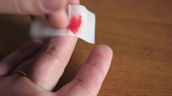 割伤的手指要用含消毒液的餐巾处理。对轻微割伤和划伤进行急救。