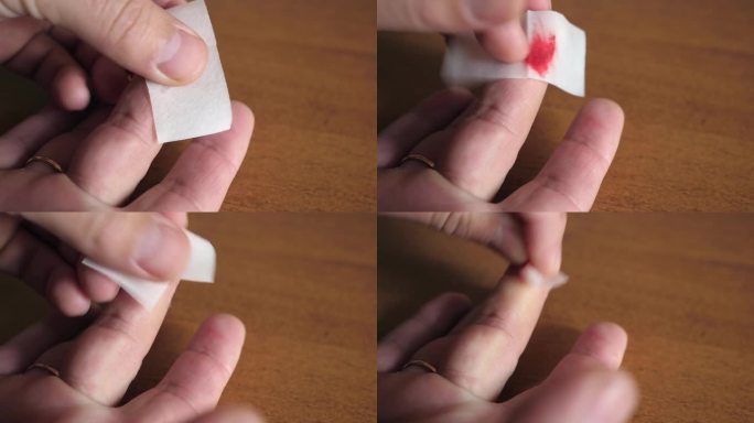 割伤的手指要用含消毒液的餐巾处理。对轻微割伤和划伤进行急救。