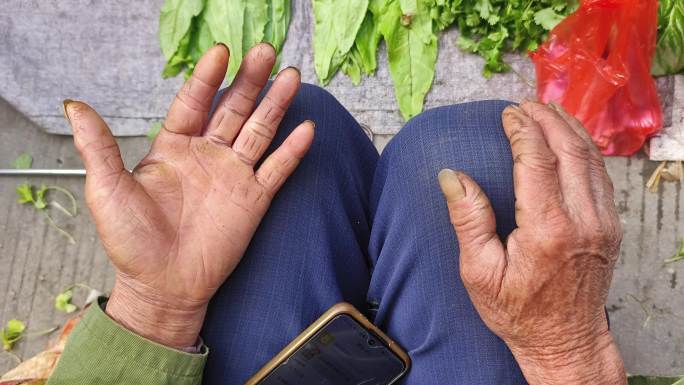 长满老茧农民手特写皮肤角质化勤劳手掌手背