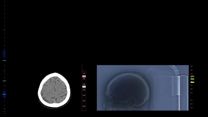 一套高科技核磁共振脑部扫描