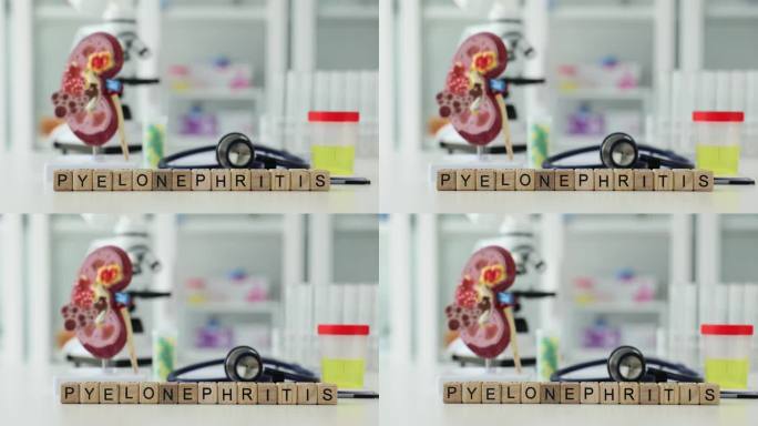 以肾盂肾炎为背景的罐子、尿液分析和人肾人工模型4k电影