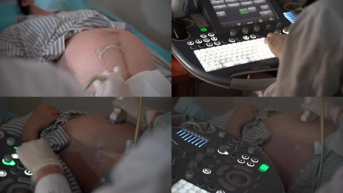 B超影像检查胎儿孕前孕妈妈产检宝宝