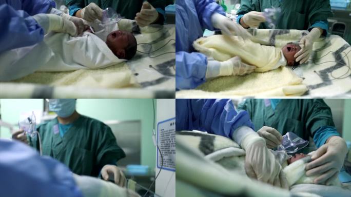 实拍新生儿 刨腹产手术 医院