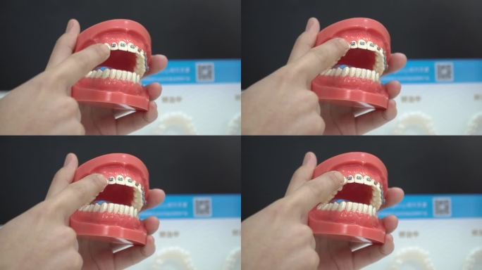 医生指牙齿模型