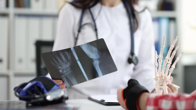 医生检查了病人的手腕和手的x光片
