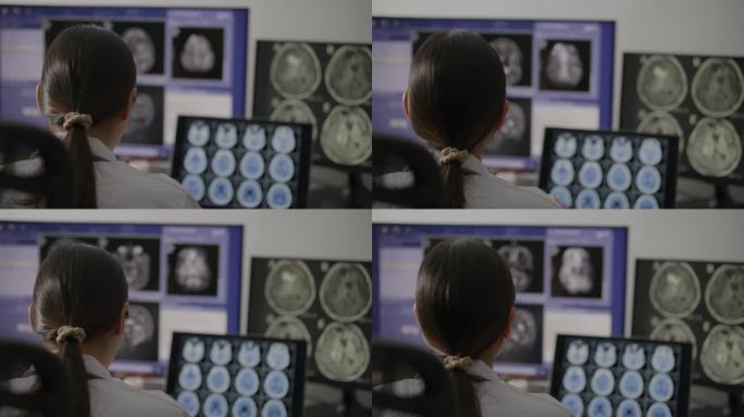 医生在控制室检查电脑屏幕上的CT扫描图像