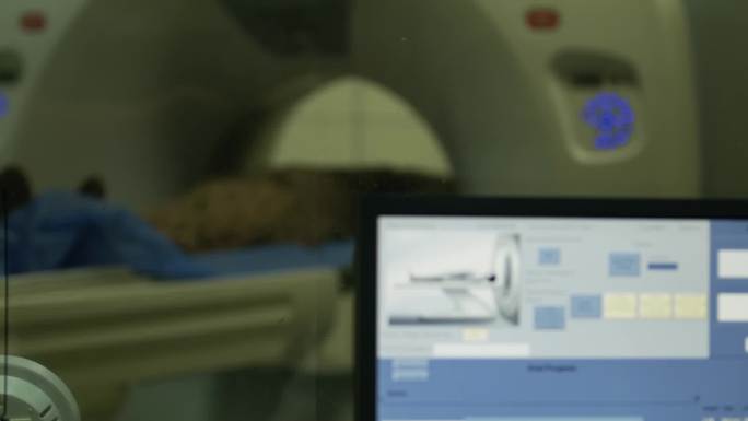 患者做脑部CT医生电脑检查CT结果
