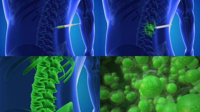 一个动画显示干细胞被注射到脊椎中