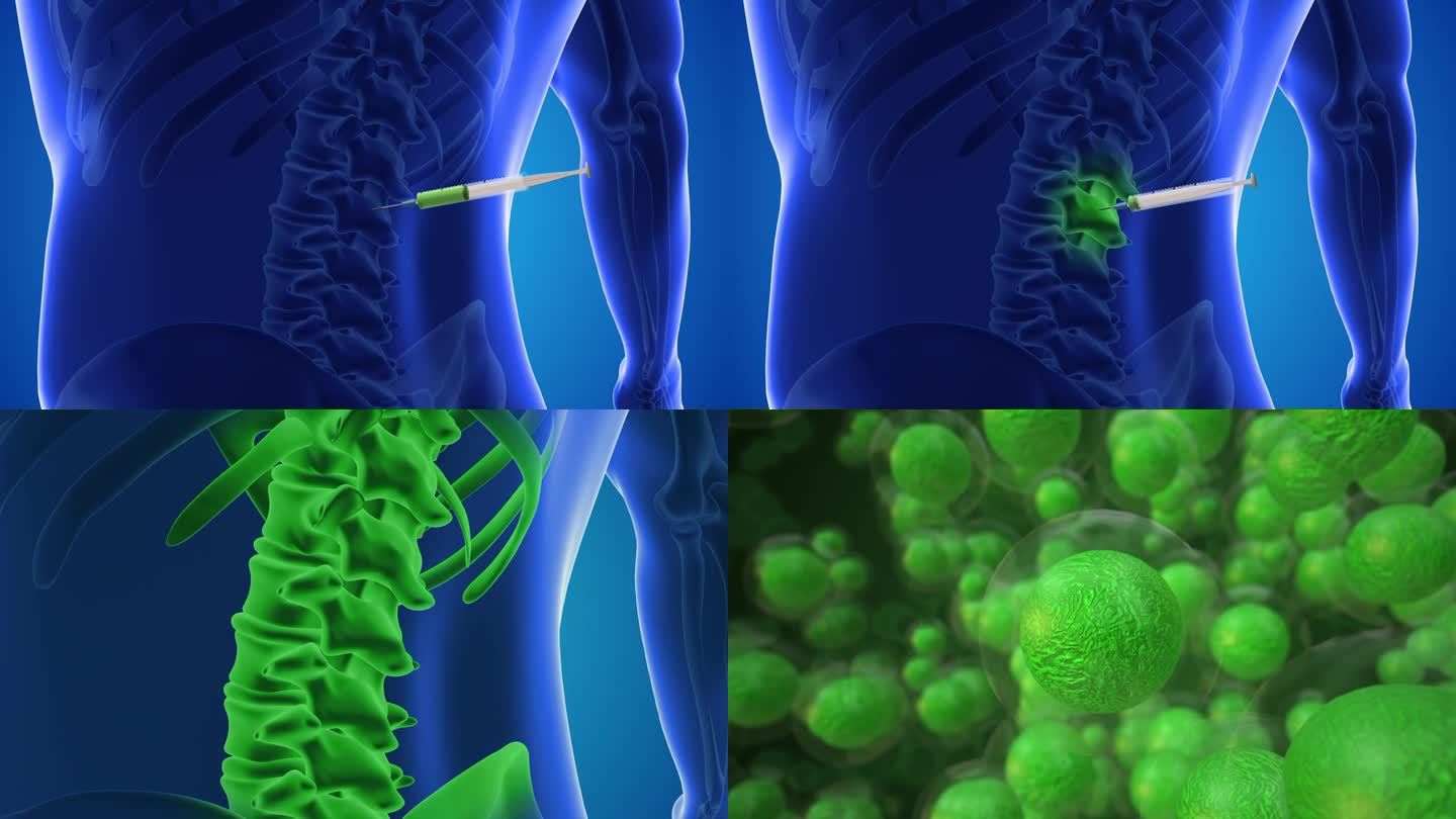 一个动画显示干细胞被注射到脊椎中