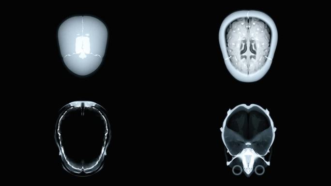 头部CT扫描动画。