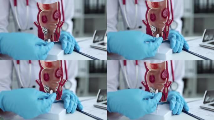 直肠科医生将直肠栓剂插入人造人体直肠模型，特写4k电影慢动作