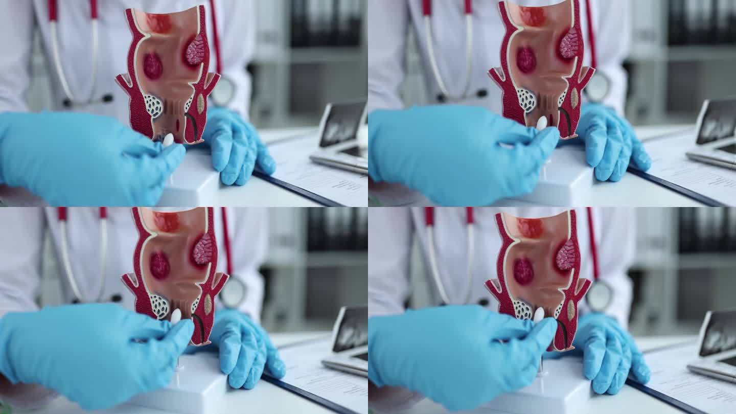直肠科医生将直肠栓剂插入人造人体直肠模型，特写4k电影慢动作