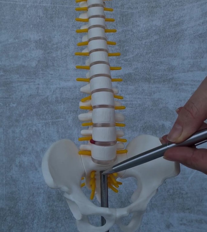 人工椎间盘突出与医疗护理脊柱的结构和模型