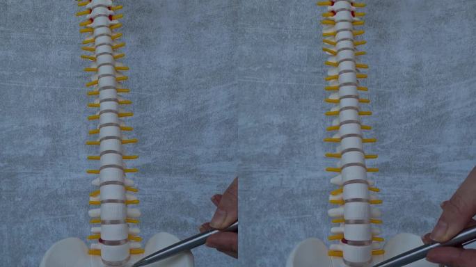 人工椎间盘突出与医疗护理脊柱的结构和模型