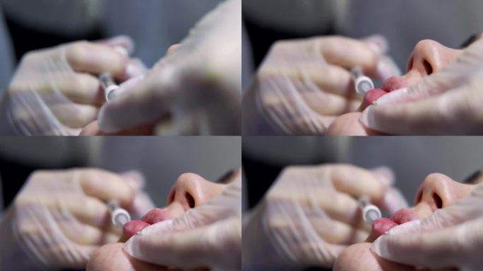 美容师在年轻美女的嘴唇上注射肉毒杆菌。极致的近距离4k拍摄