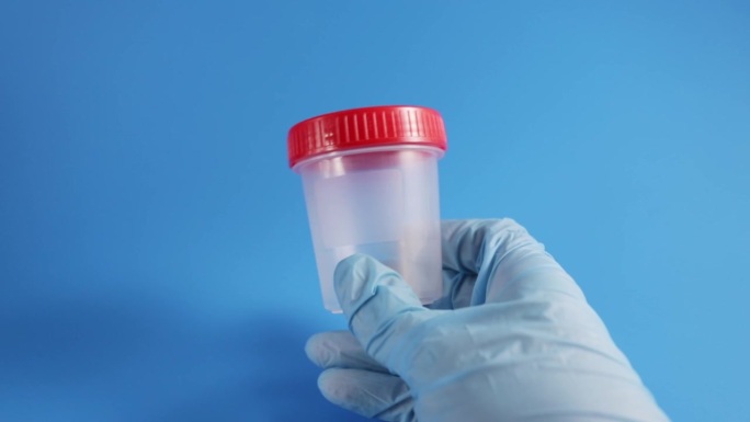 精子捐献者，用于受精和怀孕的男性精液样本罐