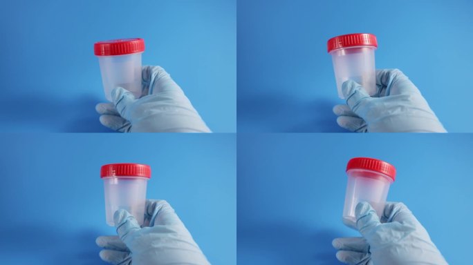 精子捐献者，用于受精和怀孕的男性精液样本罐