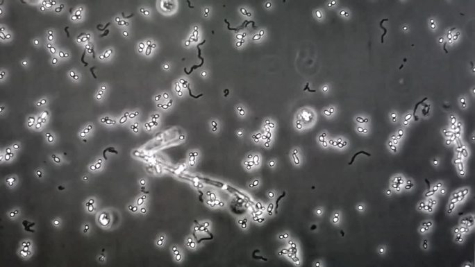 显微镜下分析患者尿液(尿路感染)、肾盂肾炎或膀胱炎中的芽殖酵母细胞。显微镜下的画面。