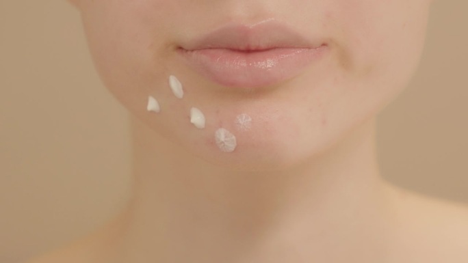 年轻女子在脸上的痘痘上涂了一种祛痘霜。