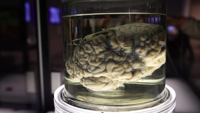 解剖博物馆的器官和人脑