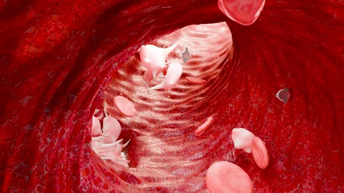 止血。血管中的红细胞和血小板，血管收缩，伤口愈合过程。血块栓塞，血友病。纤维蛋白溶解，损伤出血凝血，