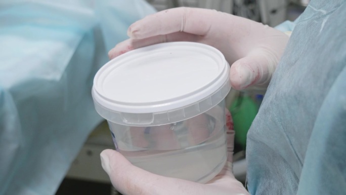 手术中，助手拿着活检罐。兽医将一块组织放入活检罐中进行组织学检查。用于送组织标本的甲醛容器。