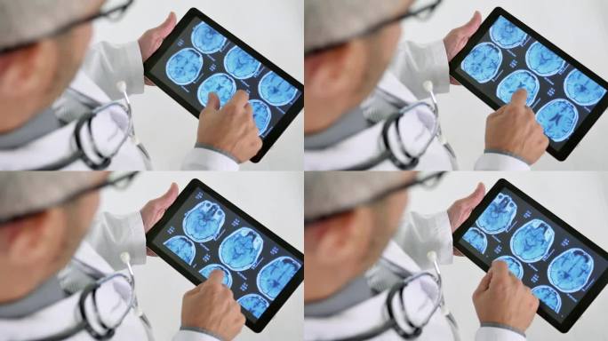 医生正在看药片上的脑部x光片