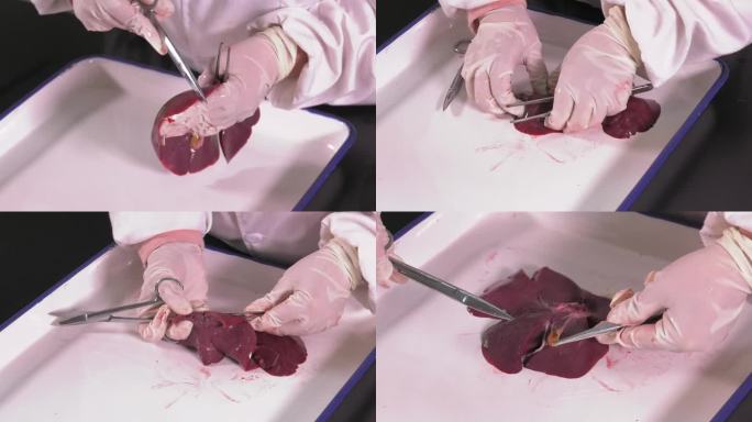 仔猪解剖 肝脏横切面 内部病变 胆囊内膜