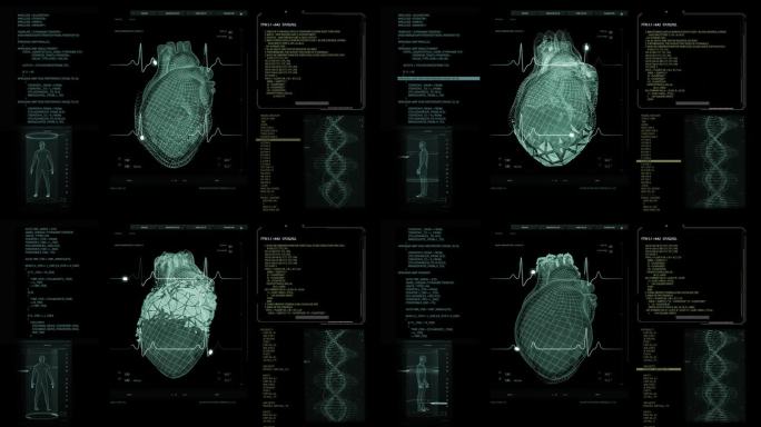 健康监测医疗软件接口的医生和诊所。深色屏幕替换心脏活动监测3D模型。重要器官可视化的用户界面
