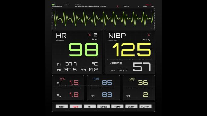 重症监护病房的病人生命体征和心电图模板，用于计算机显示器和笔记本电脑屏幕。生命体征监视器与心率和其他